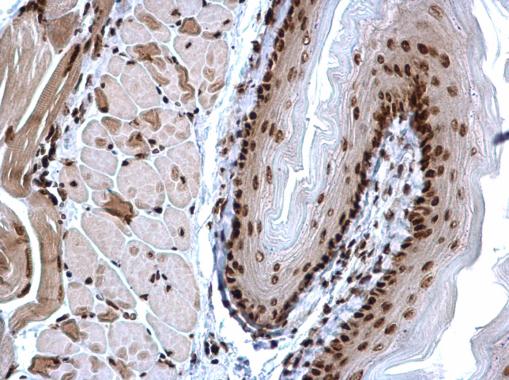 H3k4me3 Antibody Pa5 85525