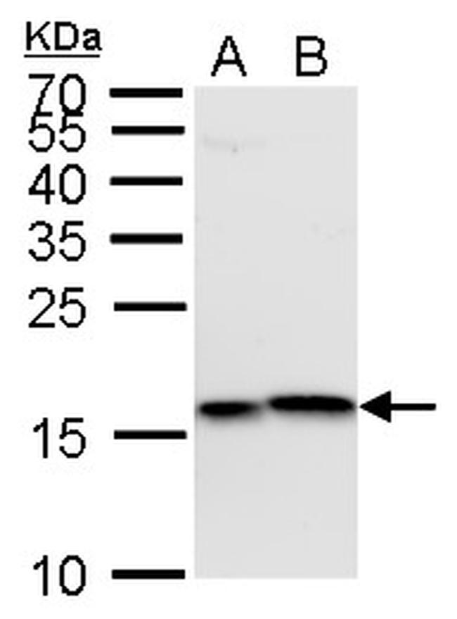 H3k4me3 Antibody Pa5 85525