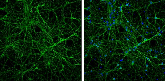 beta-3 Tubulin Antibody (PA5-85639)