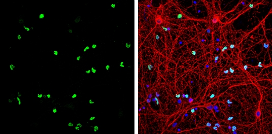 OLIG2 Antibody (PA5-85734)