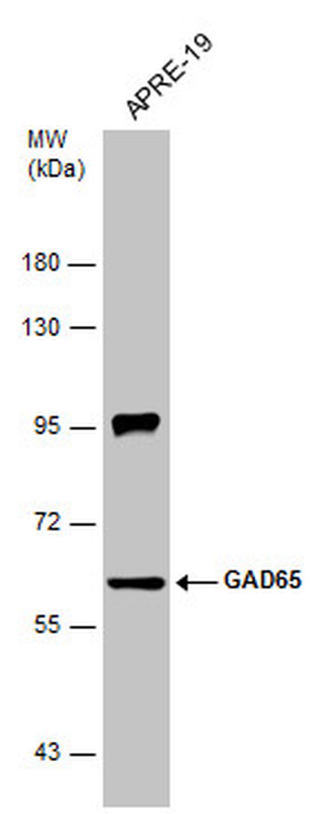 gad65-antibody-pa5-85750