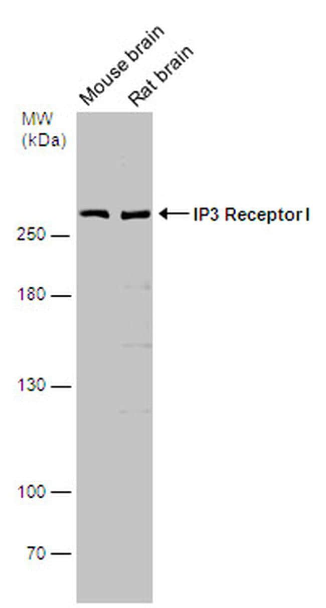 IP3 Receptor 1 Antibody (PA5-85765)