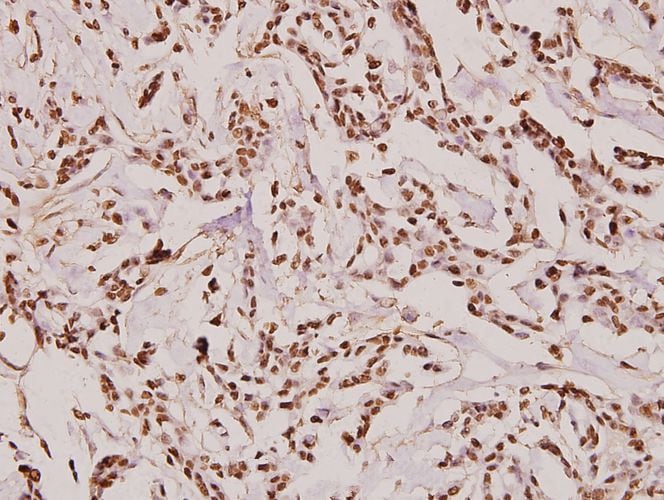 Fibronectin Antibody (PA5-86318)