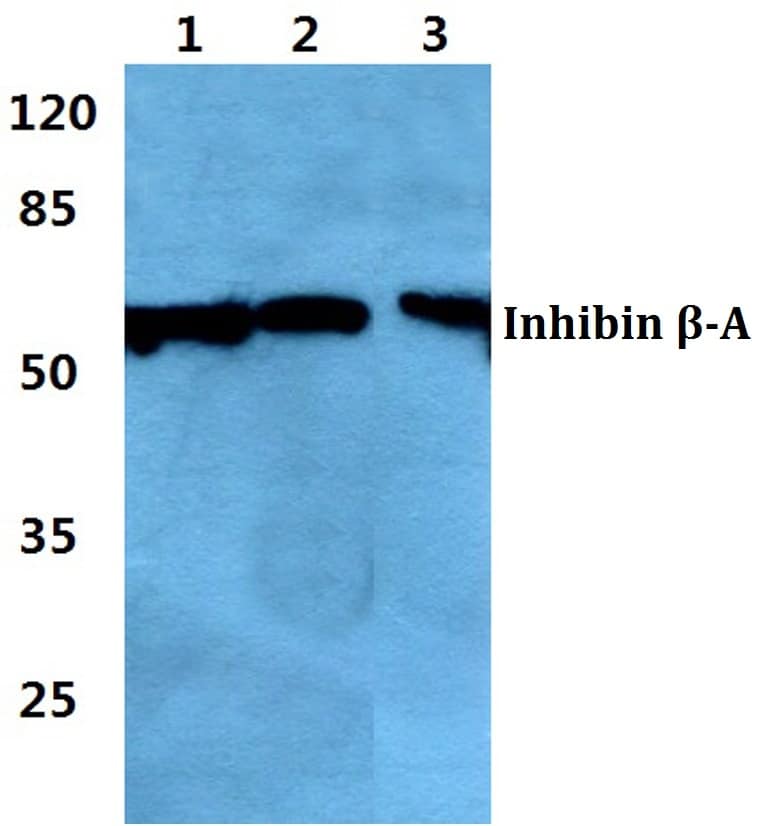 Activin A Antibody (PA5-86786)