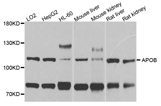 Apolipoprotein B Antibody (PA5-86950)