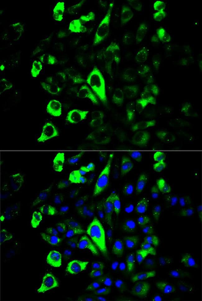 Granzyme B Antibody (PA5-87250)