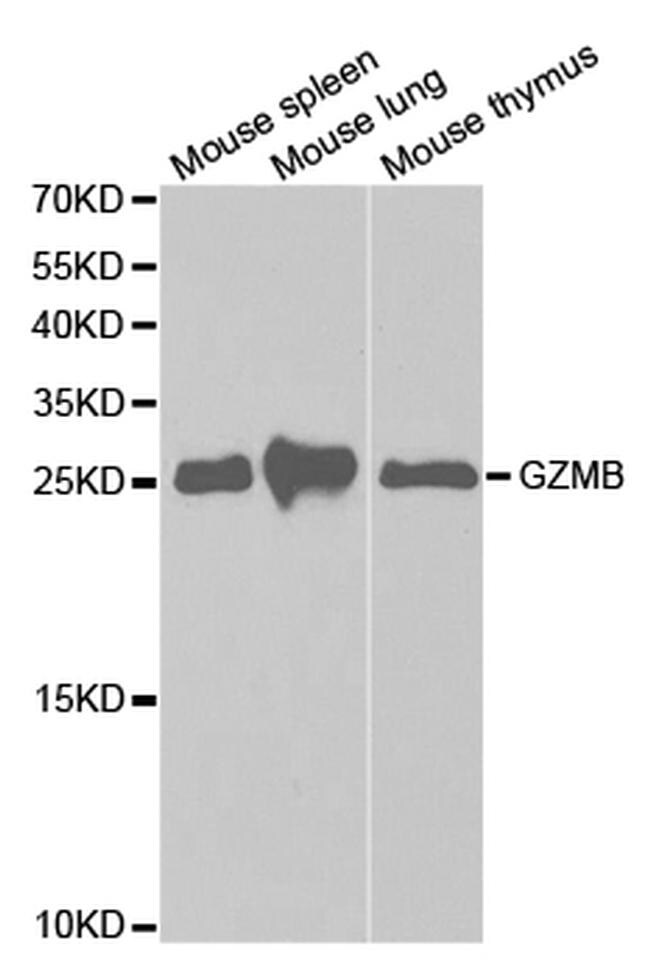 Granzyme B Antibody (PA5-87250)