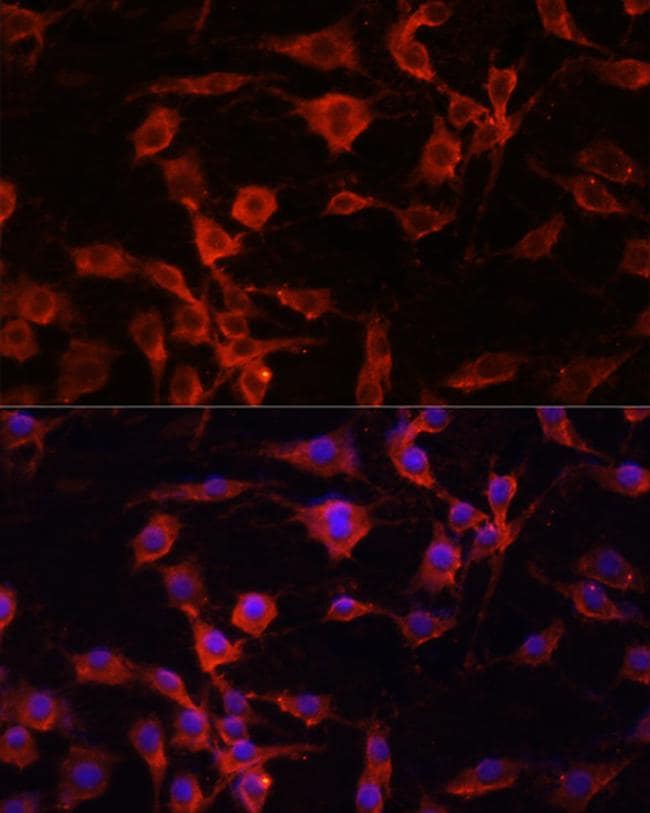 alpha-1 Antitrypsin Antibody (PA5-87677)