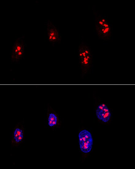 Fibrillarin Antibody (PA5-88118)