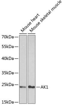 Adenylate Kinase 1 Antibody in Western Blot (WB)