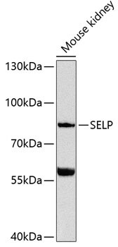 P-Selectin Antibody (PA5-88593)