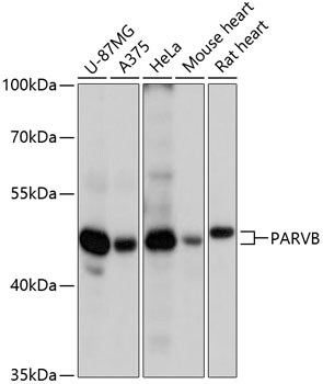PARVB Antibody in Western Blot (WB)