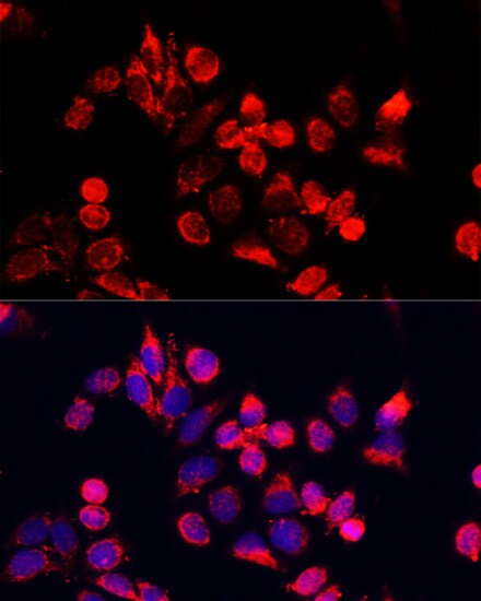 NFE2L1 Antibody (PA5-90023)