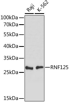 TRAC-1 Antibody in Western Blot (WB)