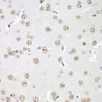 PRMT5 Antibody in Immunohistochemistry (IHC)