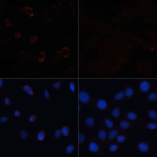 Acetyl-CoA Carboxylase Antibody (PA5-90578)