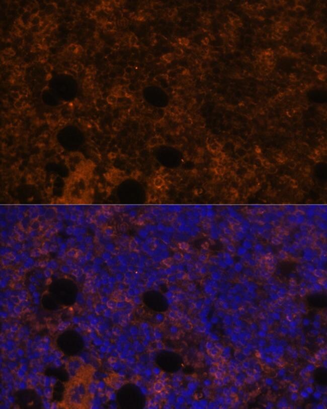 CD11b Antibody (PA5-90724)