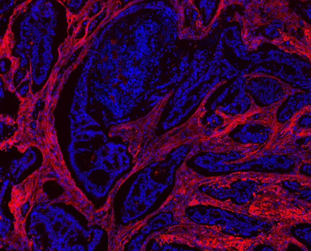 Collagen I Antibody (PA5-95137)