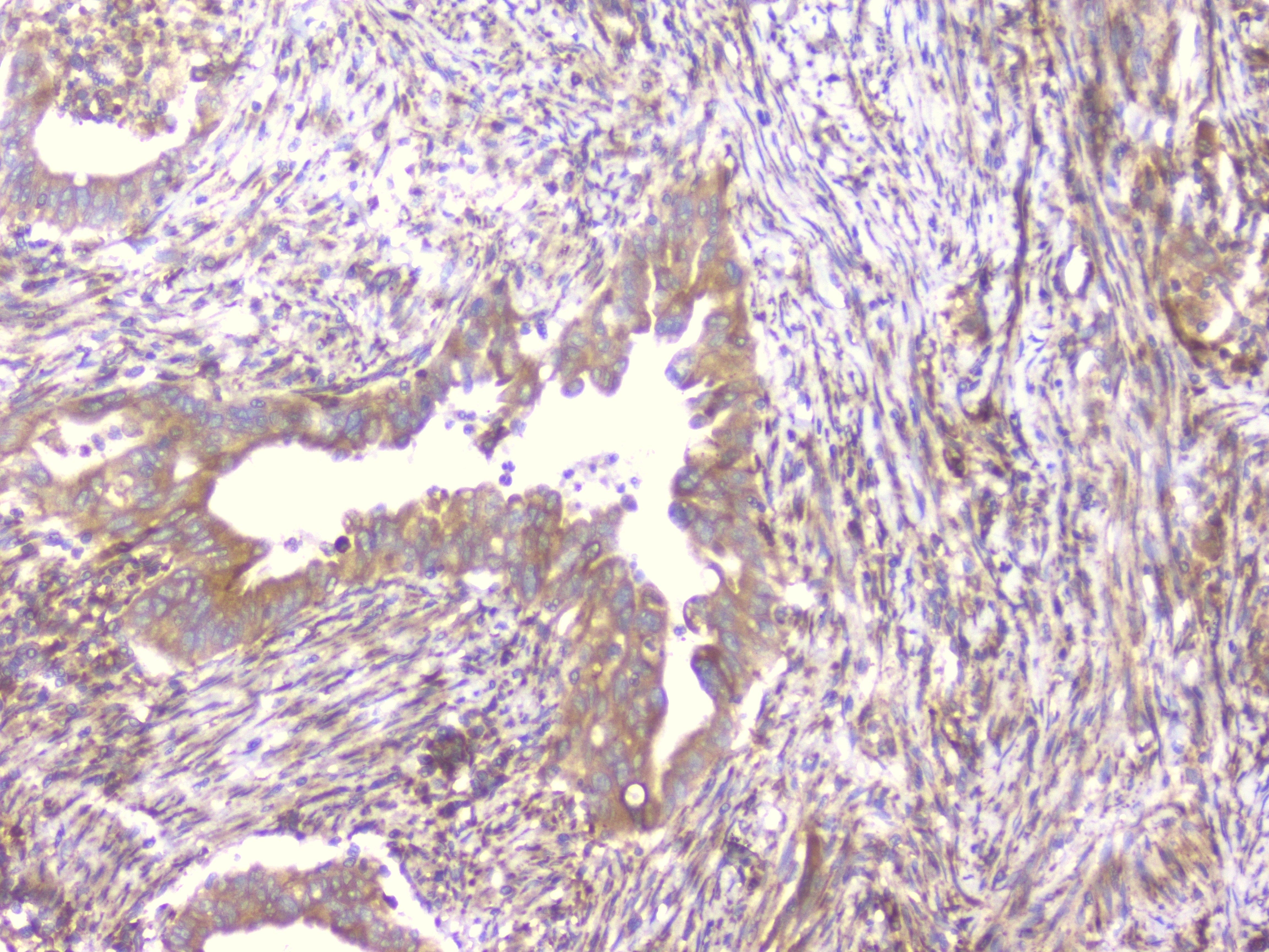 PCDH15 Antibody (PA5-95603)