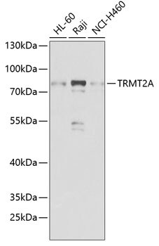 TRMT2A Antibody in Western Blot (WB)