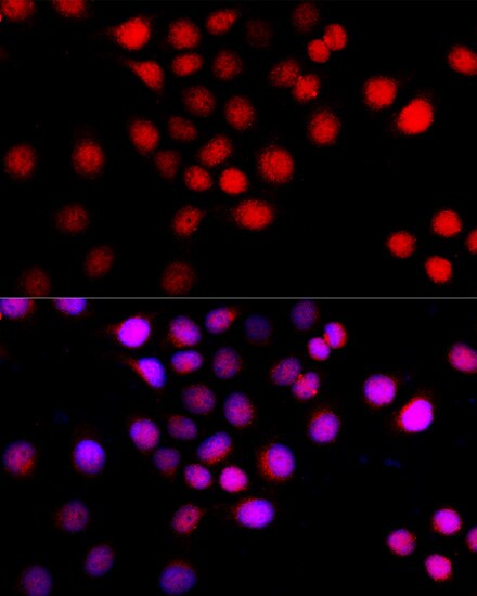 Beclin 1 Antibody (PA5-96649)