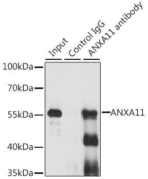 Annexin A11 Antibody (PA5-96670)