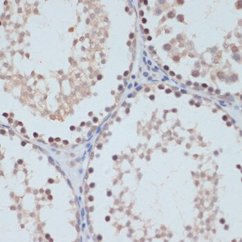 Phospho-STAT1 (Ser727) Antibody in Immunohistochemistry (IHC)
