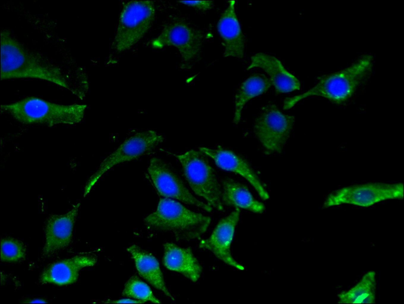 CBR1 Antibody (PA5-97546)
