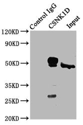 CK1 delta Antibody (PA5-97636)