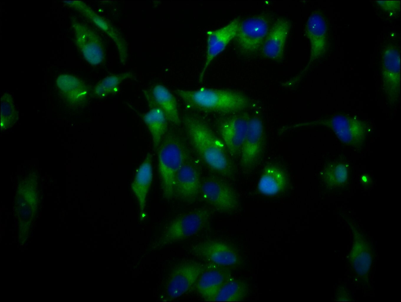 LIFR Antibody (PA5-97925)