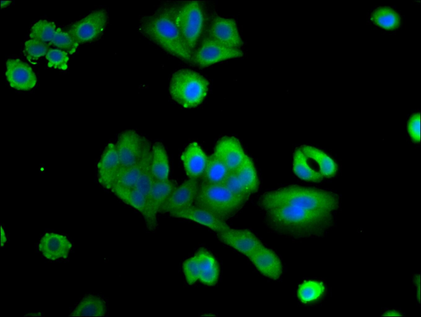 PTX3 Antibody (PA5-98102)