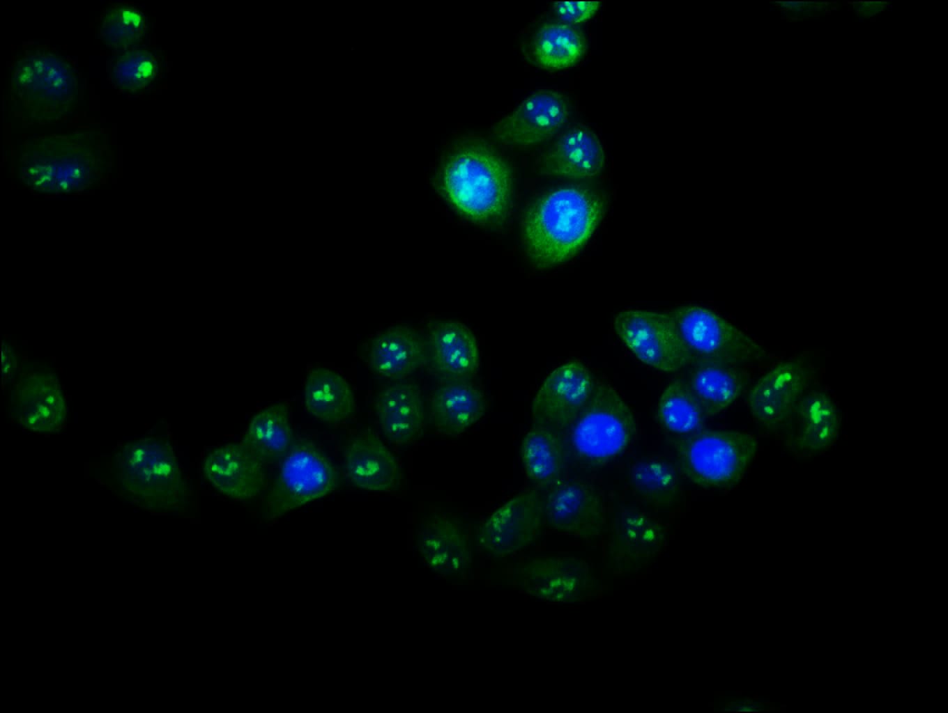 VPS25 Antibody (PA5-99005)