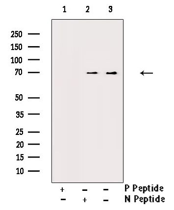 Phospho-TAK1 (Thr187) Antibody in Western Blot (WB)