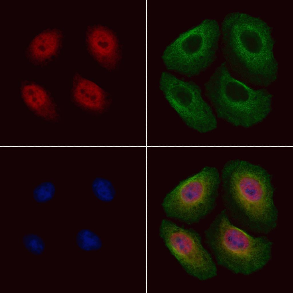 Phospho Srebp1 Ser439 Antibody Pa5 99371