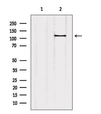 Phospho-PLA2G4A (Ser505) Antibody in Western Blot (WB)