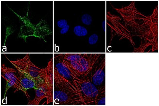 intermediate filament-based process antibodies