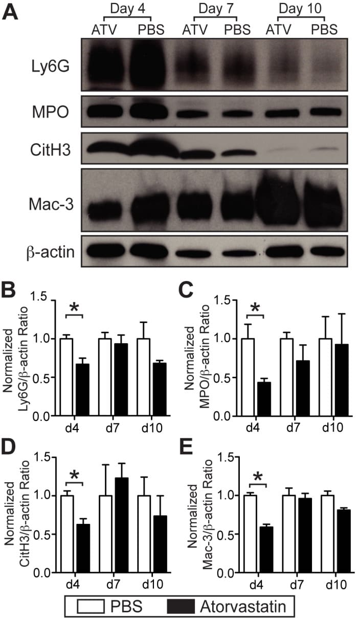 Myeloperoxidase Antibody