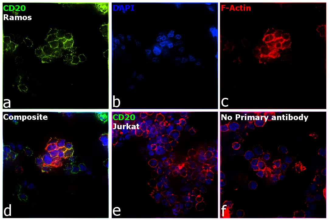 CD20 Antibody (PA5-16701)