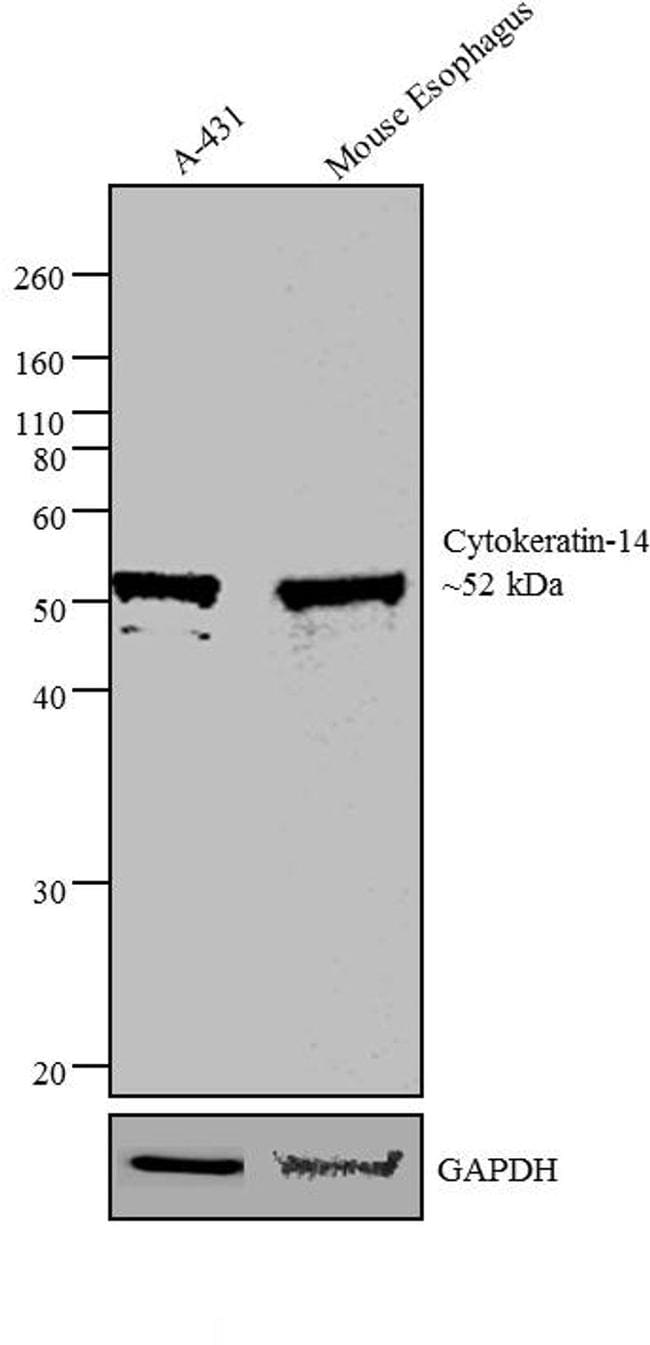 Cytokeratin 14 Antibody in Western Blot (WB)