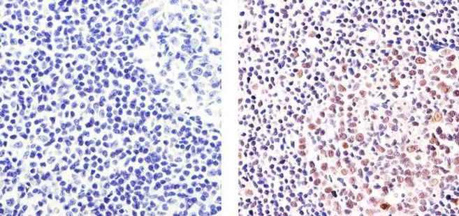 ki 67 antibody ki67 staining