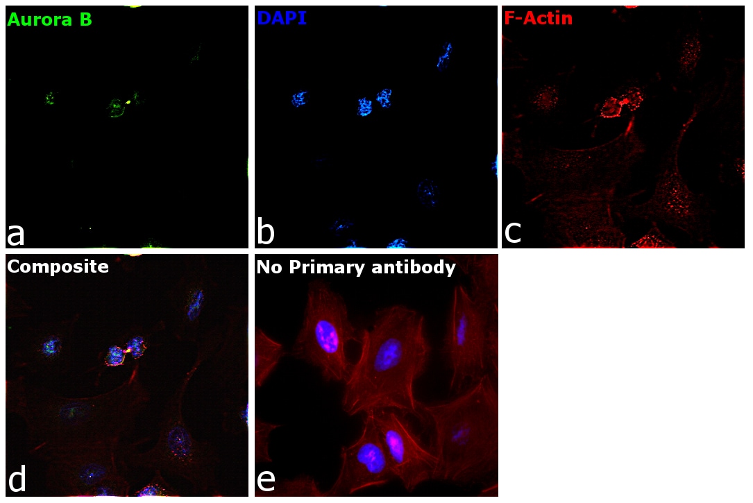 Aurora B Antibody (PA5-17632)