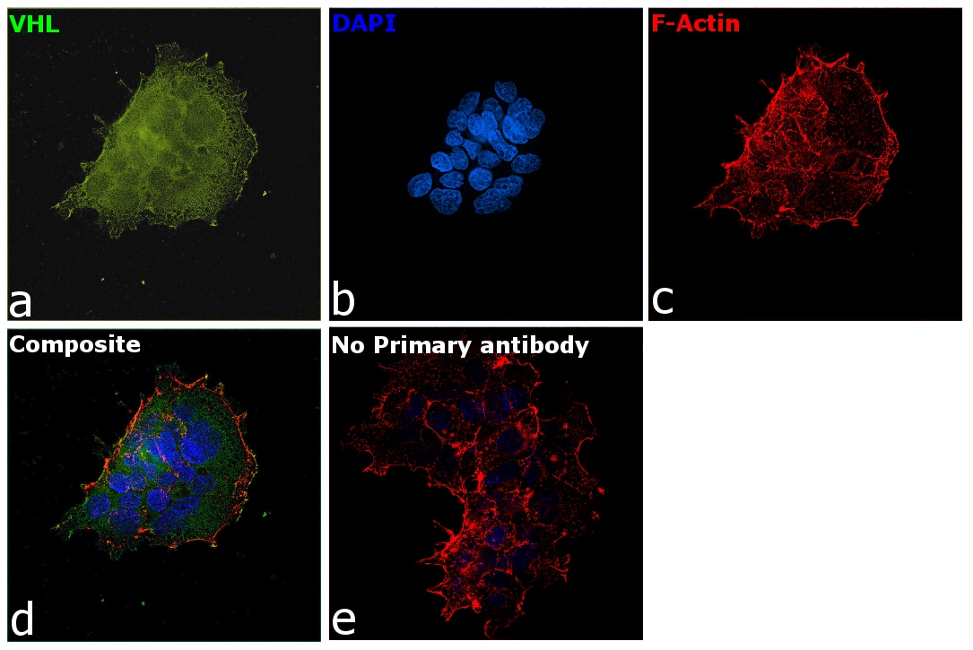 VHL Antibody in Immunocytochemistry (ICC/IF)