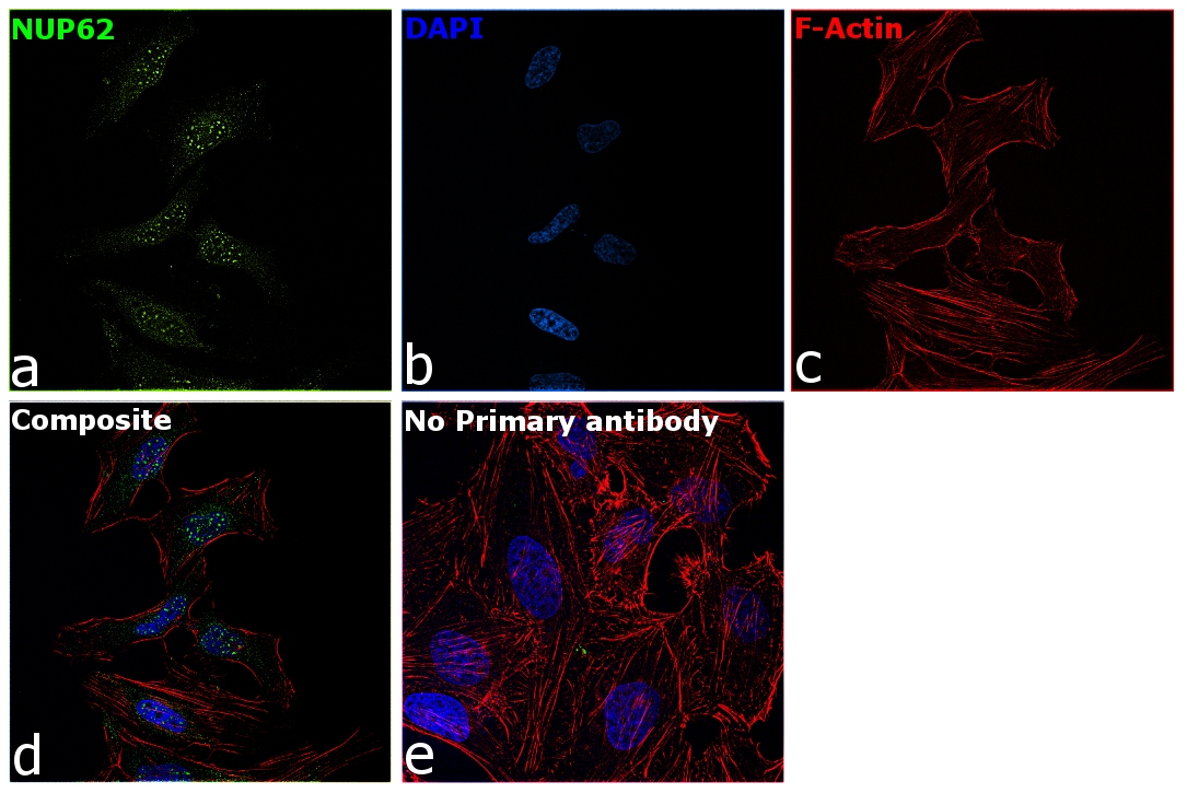 NUP62 Antibody (PA5-21435)