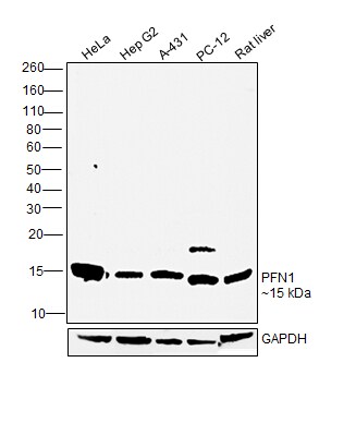 Profilin 1 Antibody in Western Blot (WB)
