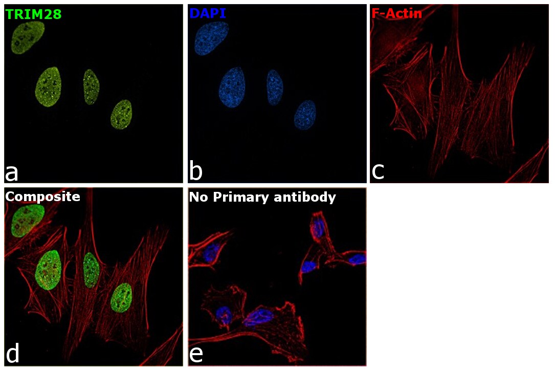 TRIM28 Antibody in Immunocytochemistry (ICC/IF)