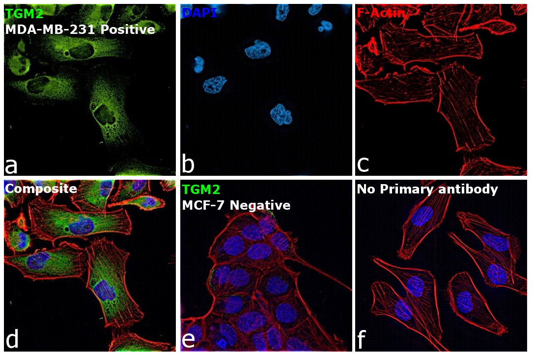 Tgm2 Antibody Pa5 29356