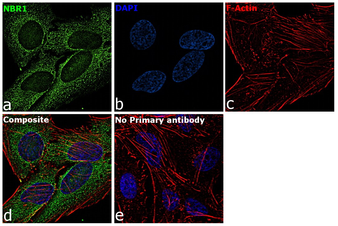 NBR1 Antibody (PA5-30085)