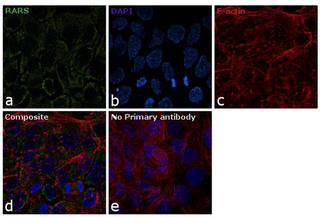 RARS Antibody (PA5-30145)