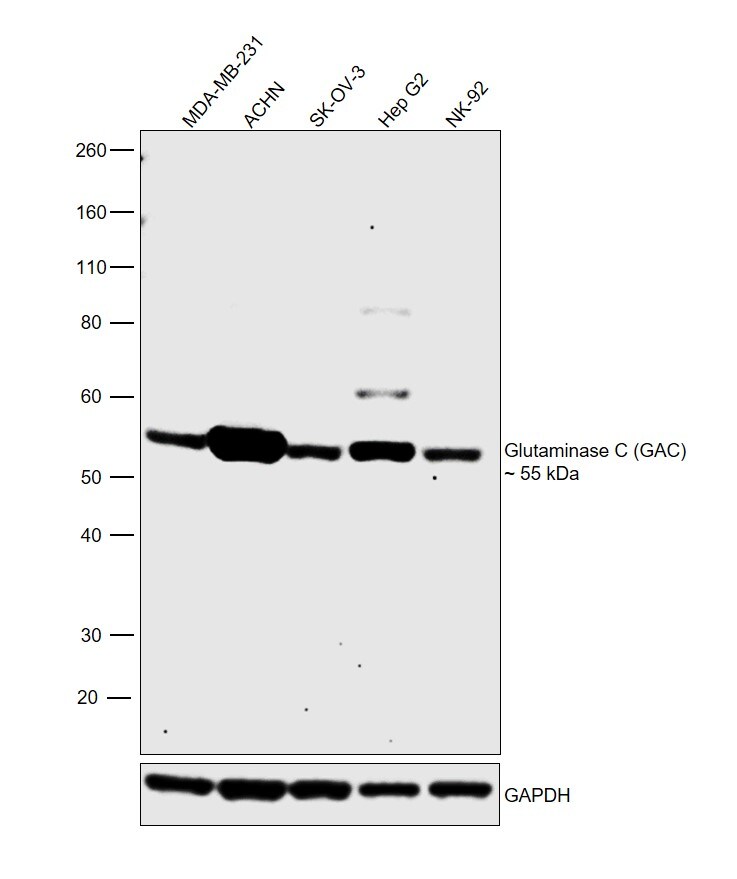 Glutaminase C (GAC) Antibody in Western Blot (WB)