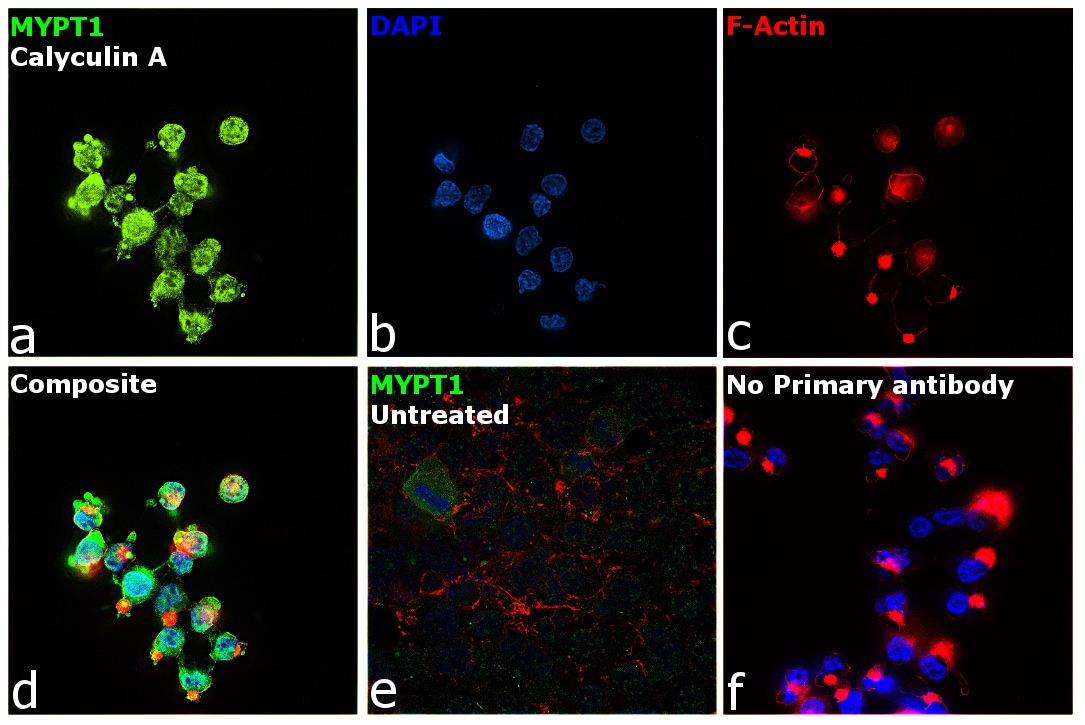 Phospho-MYPT1 (Thr853) Antibody in Immunocytochemistry (ICC/IF)